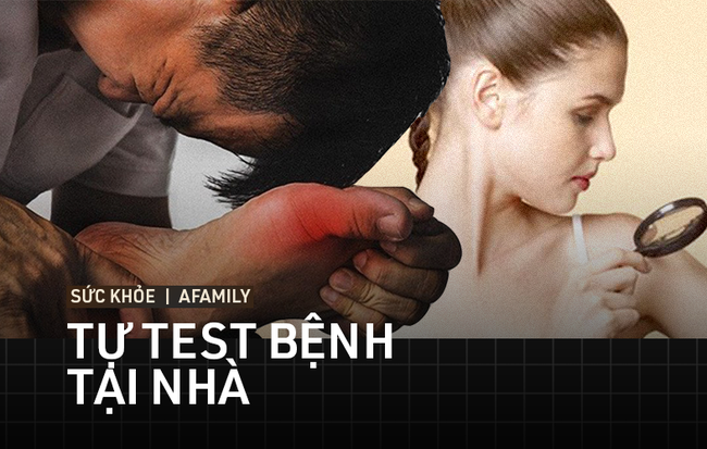 10 bài test giúp bạn tự kiểm tra sức khỏe, sớm phát hiện mình đang mắc bệnh gì để điều trị kịp thời